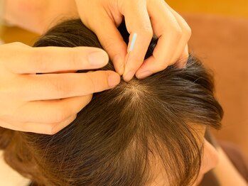 ととろはりきゅう院/頭のツボで花粉にアプローチ