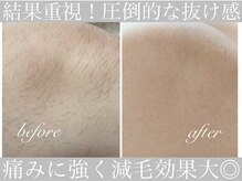 アリスビューティー(AliceBeauty)/圧倒的抜け感！満足度◎