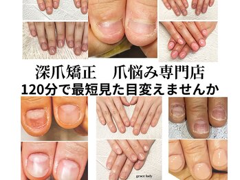 グレースレディ