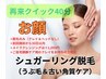 再来★30日以内★シュガー脱毛のみ（顔、うなじ）40分/メイクオフは＋1,000円