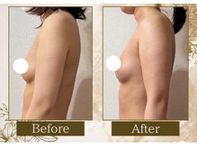 マリン(MARINE)/Before→After