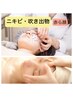 ニキビ・赤ら顔【美顔鍼×フェイシャルエステ】小顔美鍼(70分)￥15,400→