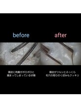 マナワ(manawa)/ヘッドスパ施術 before→after