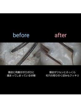 マナワ(manawa)/ヘッドスパ施術 before→after