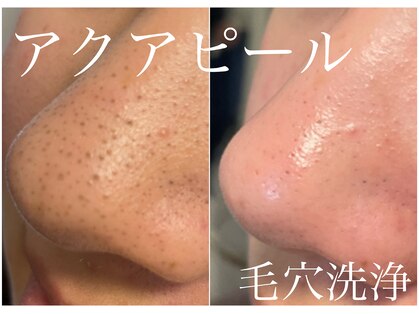 ミープラス(Me+)の写真