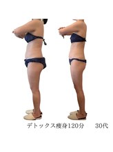 コーラル(Coral)/デトックス痩身（施術結果）