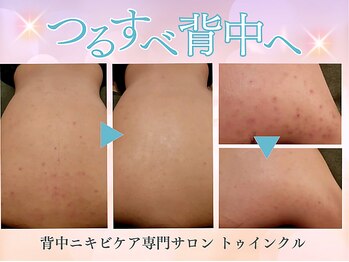 プライベートエステサロン トゥインクル