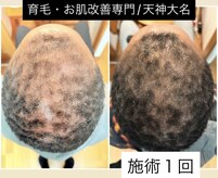 ウィズサロン 天神大名店(withサロン)