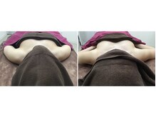 トータルビューティーサロン ナーズ(NAZ)/光バストアップ