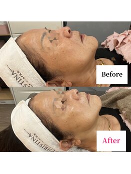 エリー(ERIE)/クリスティーナ イラストリアス