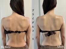 アール アンド ビューティーサロン(Ｒ＆ BeautySalon)/ブライダルエステ