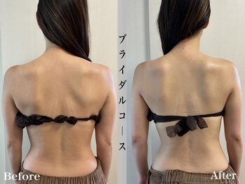 アール アンド ビューティーサロン(Ｒ＆ BeautySalon)/ブライダルエステ