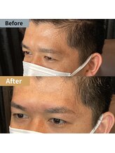 眉毛ハウス 吉祥寺店(眉毛HOUSE)/お客様の施術例(吉祥寺/東京)