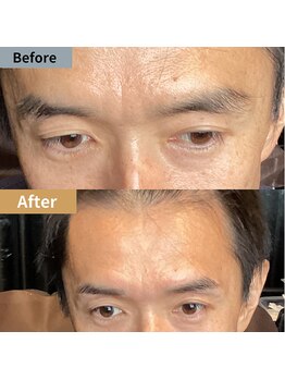 眉毛ハウス 吉祥寺店(眉毛HOUSE)/お客様の施術例(吉祥寺/東京)