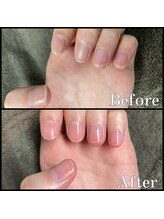 眉毛男子 新宿店/ネイルケア【 before / after 】