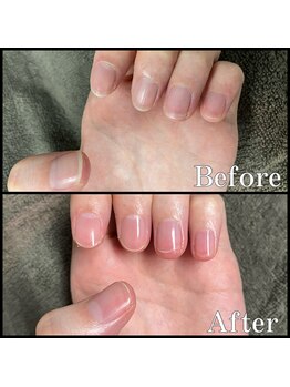 眉毛男子 新宿店/ネイルケア【 before / after 】