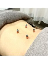 かねこ鍼灸接骨院/熱すぎないぽかぽかお灸♪