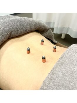 かねこ鍼灸接骨院/熱すぎないぽかぽかお灸♪