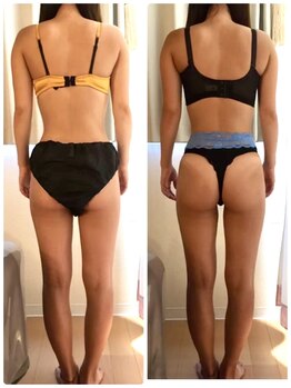 シエスタ(SIESTA)/Before→After 美尻＆美脚！