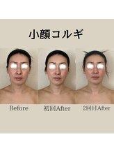 リーブル(LIBRE)/小顔コルギ　2回