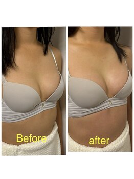 ベッピン(Beppin)/静岡バストケア/静岡育乳