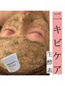 【毛穴とニキビケア】ハーブピーリング+ヘッドマッサージ付15,400円→9,900円