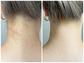 コルリース(COL Riys)/