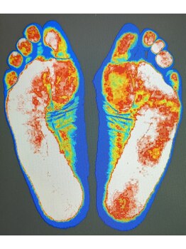 中央治療院/足型画像