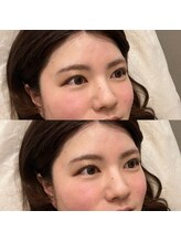 モモ(Momo.)/韓国まつ毛パーマ