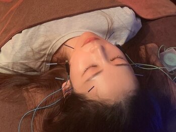 ハリアージュ(Hariage)の写真/年齢サインに負けない自然な綺麗さへ◇美容鍼×独自の美容施術で諦めていたお顔のゆるみたるみを徹底ケア
