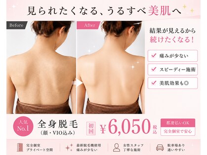 エスポワール ビューティ(Espoir beaute)の写真