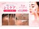 シュシュ(CHUCHU)の写真