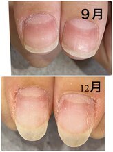 グレースレディ 神戸北店/