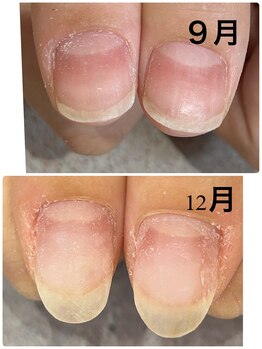 グレースレディ 神戸北店/