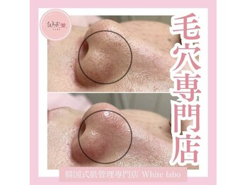 ホワイトラボ 宝塚(White labo)/韓国肌管理専門店White labo宝塚