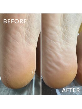 アトリエシロップネイル(Atelier Syrup nail)/