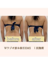 コンバートビューティーオタイ(ConBert Beauty otai)/くびれラインすっきり♪