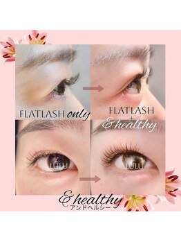 アイラッシュサロン ルル(Eyelash Salon LULU)/フラットラッシュ+&healthy