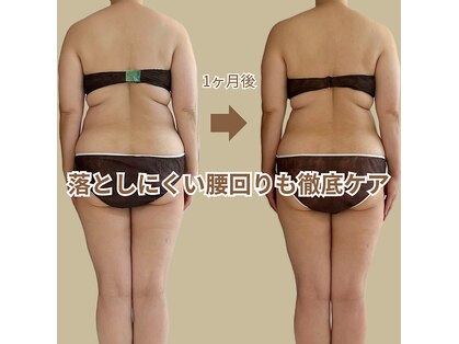 ヒールプラス(heal+)の写真