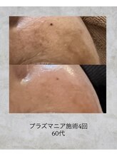 コンクパール(CONCH PEARL.)/プラズマニア