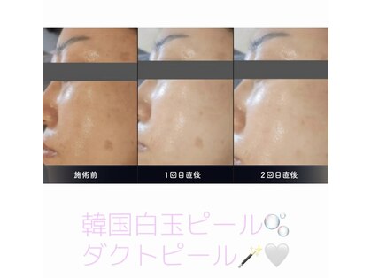 エクリュ(ECRU)の写真