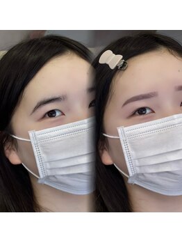 チル アンド アイ 船橋駅前店(Chill&Eye)/美眉スタイリング/BeforeAfter