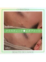 ボーテ ドゥ ランジュ(BEAUTE DE L’ANGE.)/◆ビオフィート◆