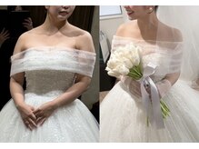 凛&美 銀座/7回施術のビフォーアフター