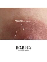 モア(more.)/乳輪のダウンタイム皮むけ