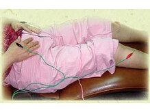 上葉鍼灸接骨院の雰囲気（針麻酔）