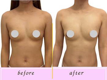 ビーハピネス 京都西院(B-Happiness)/20代上半身の広がり感がスッキリ