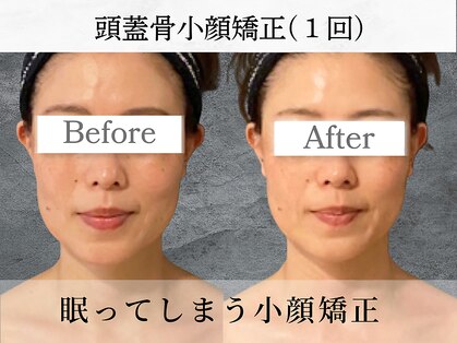 シャムリー(SHAMRY)の写真