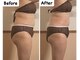 ナユラスパ(Nayula Spa)の写真/【新機種導入/本格痩身】キャビ＋ラジオ波＋吸引＋痩身マッサージ付き本格痩身が受けられるサロン♪