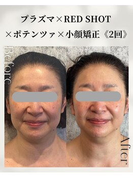 ネイルアンドアンチエイジングドゥシール(Docile)/50代女性｜小顔・二重あご改善